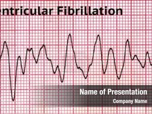 Heart Rhythm PowerPoint Template