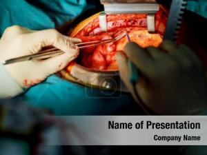 Cardiac Surgery PowerPoint Template